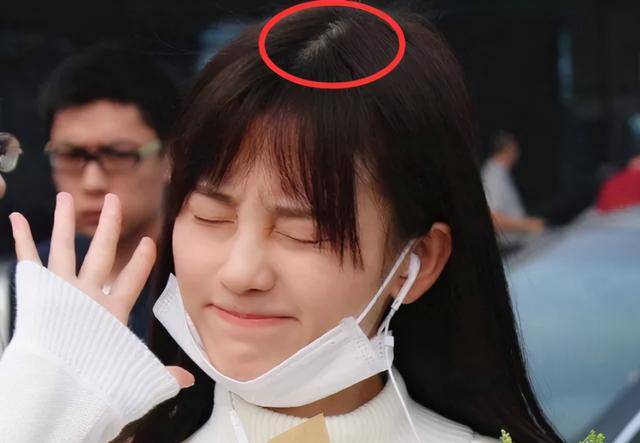 蒋梦婕|女明星为了发际线有多拼？蒋梦婕戴假发片，鞠婧祎糊了满脑袋粉