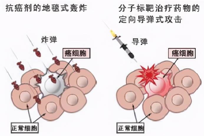 癌症病人口水减少_癌症病人图片(3)