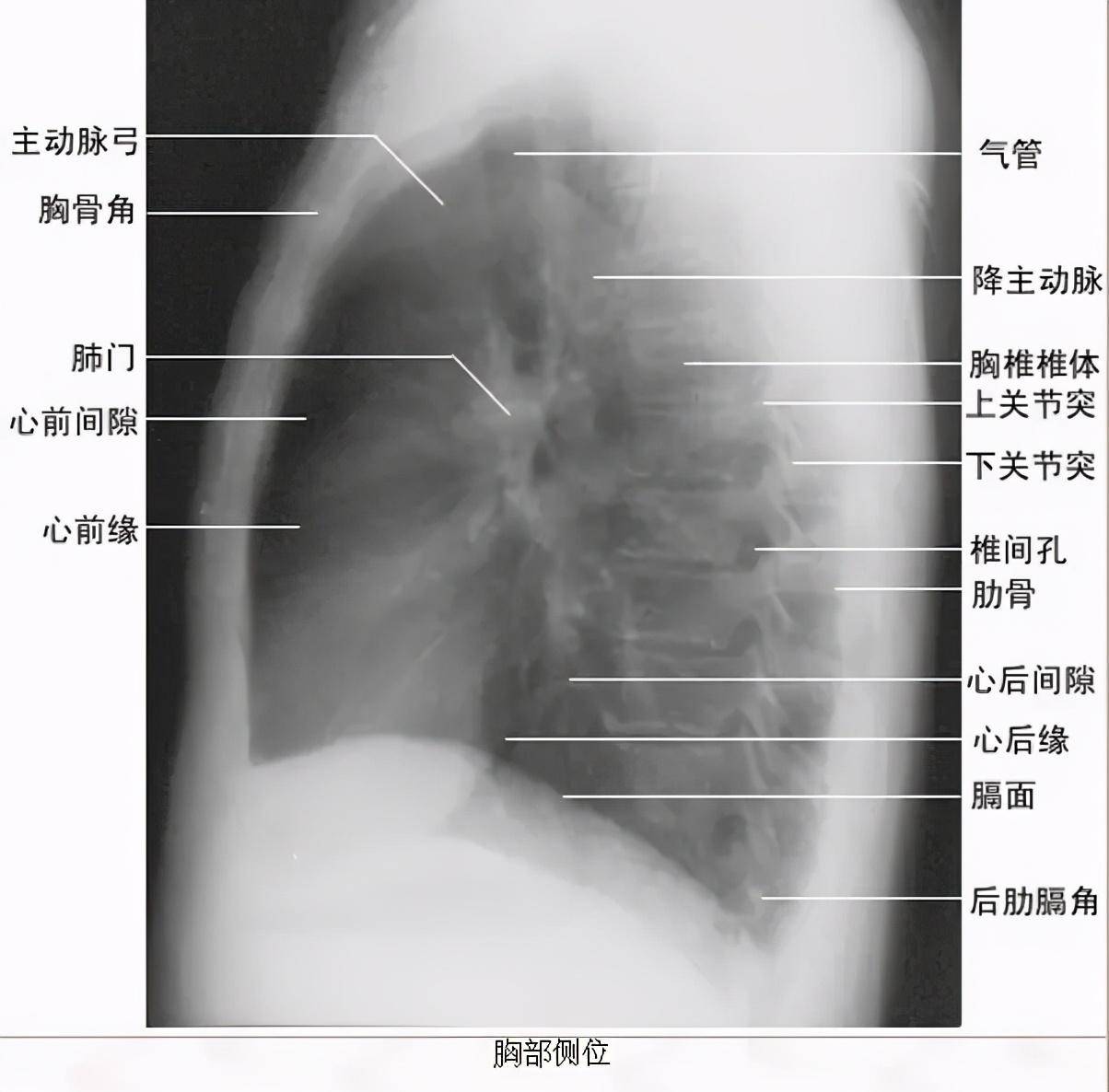 胸片入门攻略,看完不信你还学不会!