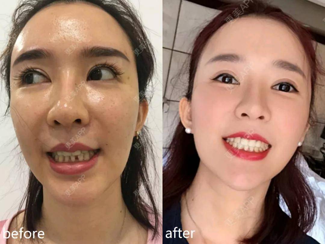 李沁|又一对顶流即将官宣？