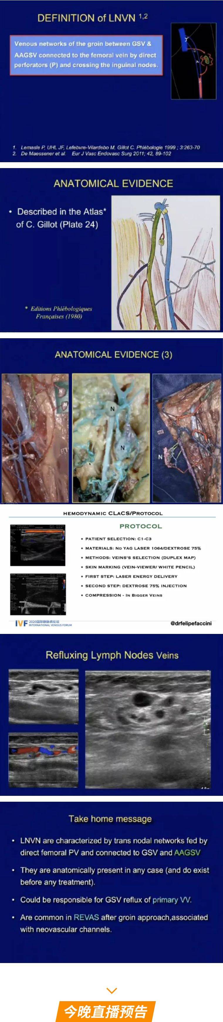 静脉|第四天静脉超声与解剖专场+今日会议预告