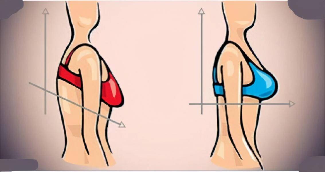产后胸部下垂,崩溃的问题这样解决,让你的身材不翻车!