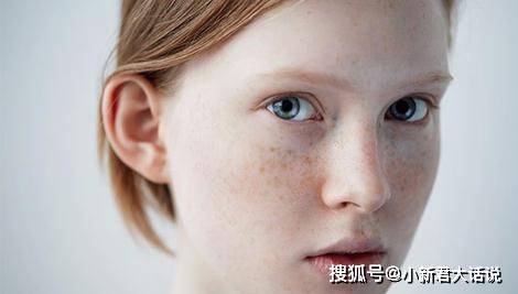 吃什么能消除脸上黑色素 a4d29ad35cf74f919236c94c9de0e894.jpeg