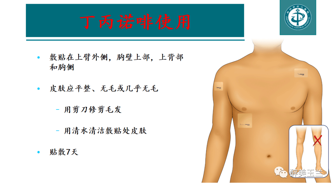 术前不间断使用丁丙诺啡透皮贴对术后疼痛管理的影响