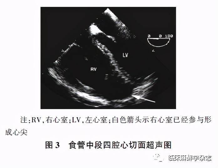 经食管超声心动图在非心脏手术中应用专家共识 (2020版)
