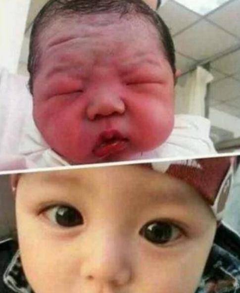 孩子|3个部位越“丑”，长大颜值越高，很少有人三条全中宝刚出生