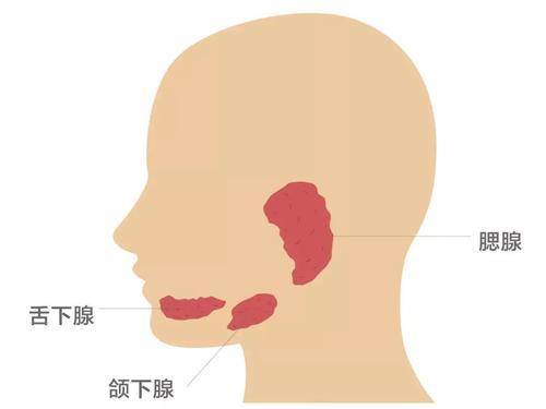 广药三院肿瘤一科丨腮腺癌是什么引起的