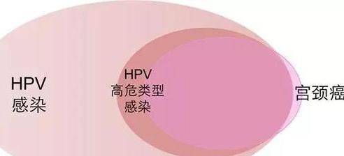 高危型hpv病毒是怎么感染的