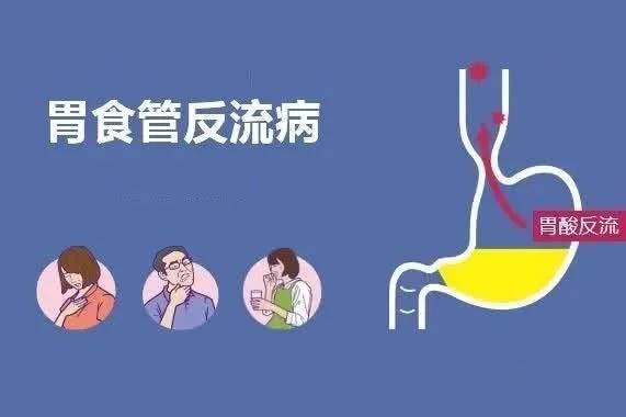 饭后返胃酸怎么办