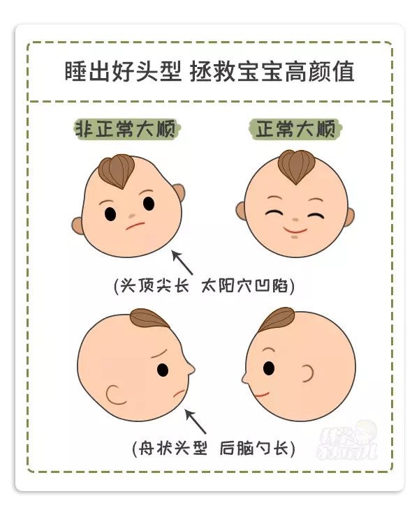 婴儿左右脸不对称怎么办 f780ea74f9994b6dbda5a304dbde5a00.png