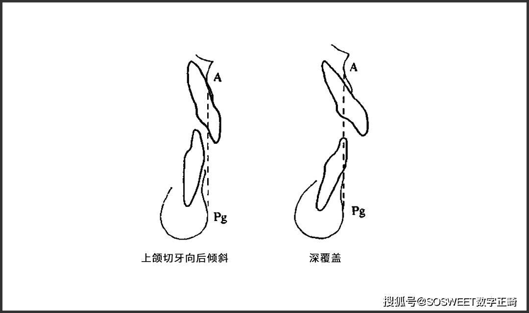 什么牙切齿成语_成语故事图片(3)