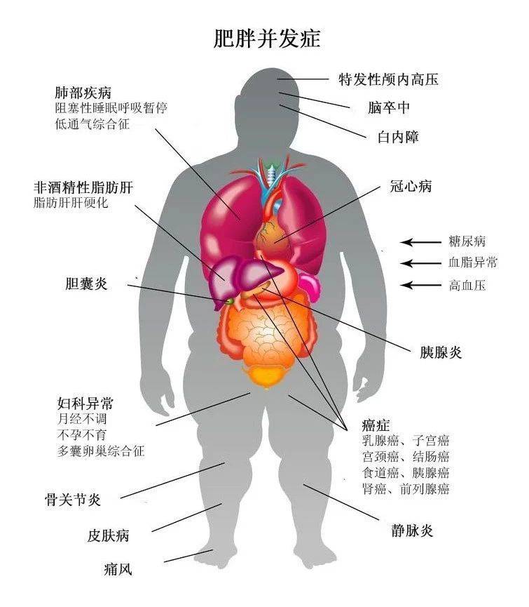 肥胖人口比例_中国肥胖人口占比