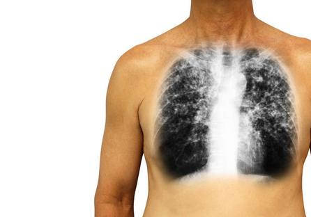 吃什么东西对肺部最好 e76f9926e78c4b8d92919381fb3d3284.jpeg