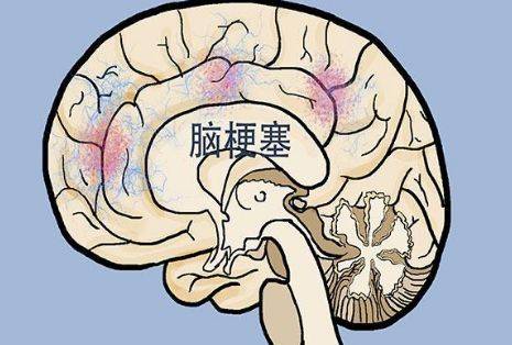 44c71e0bbf4c487eac5704124c098cb5.jpeg