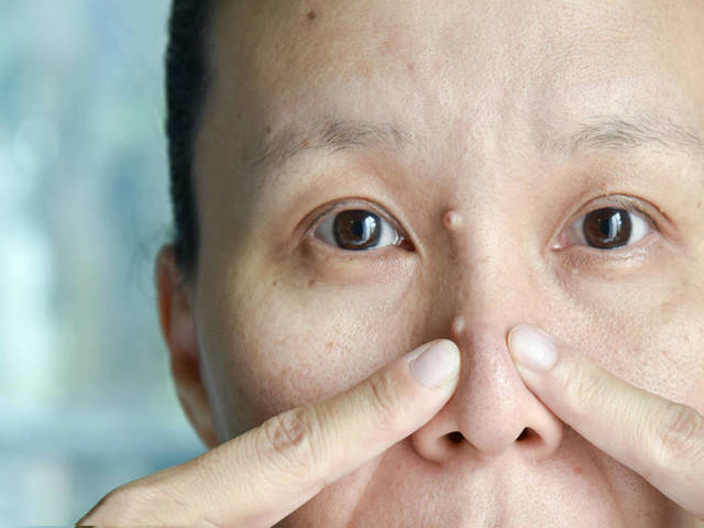 如果你好好睡觉,而且勤敷眼膜都无法改善,那么还有一个原因那就是肝脏