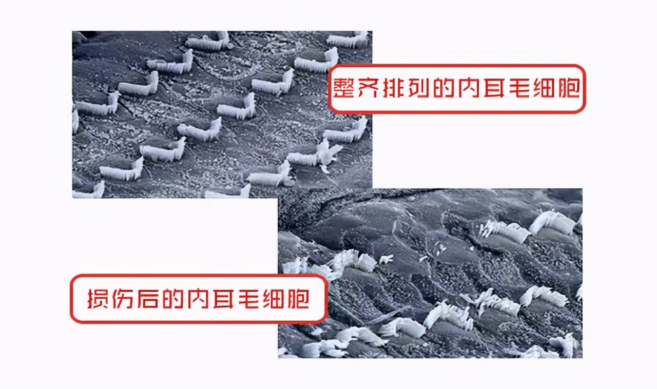 下塞什么聋成语_成语故事简笔画(2)