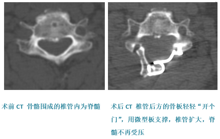 一半脑袋麻木怎么办