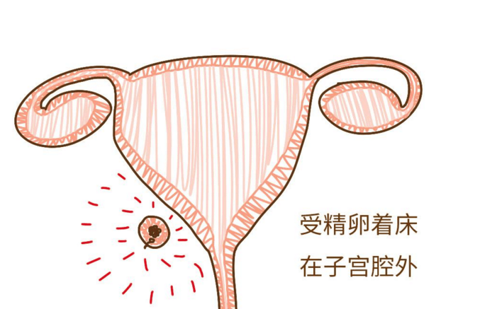 317fbaa69a474e9095200aafdecaece0.png