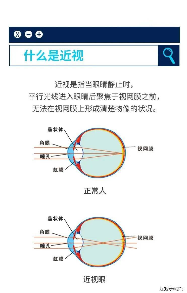 我国近视人口_科普贴 几大易混淆的视力问题