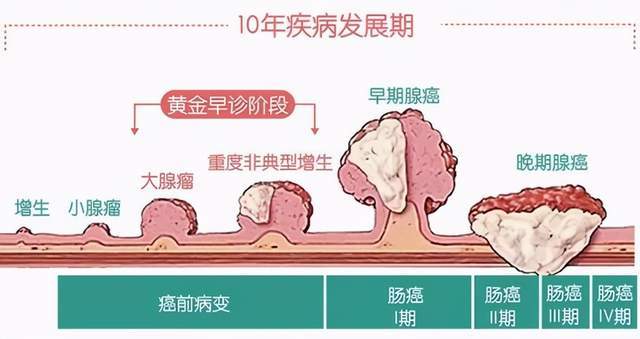 乳糖不耐症佔人口比例_乳糖不耐症大便照片(2)