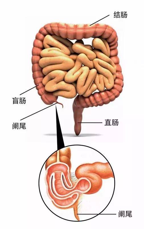 【阑尾炎的症状】