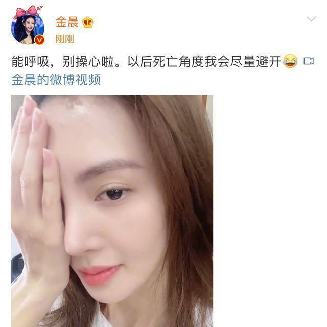 金晨继嘴歪后因鼻子太尖被疑整容，本尊回应：