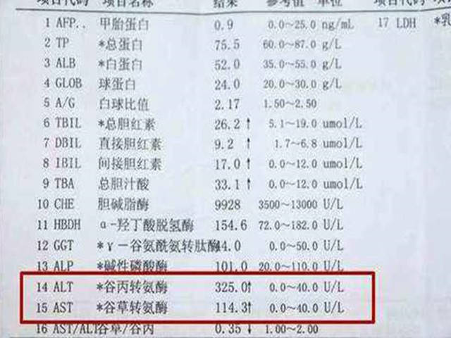 肝功GDP45偏高一点_去医院检查肝功 检查出了小三阳 ,还有别的什么数值偏高,