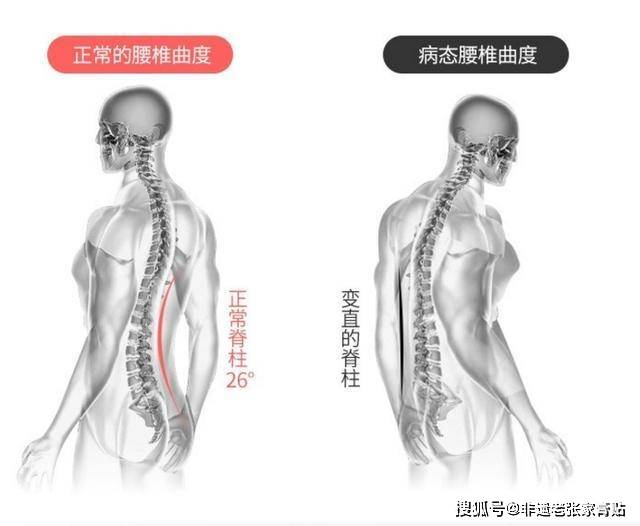 2021非遗老张家膏贴:腰椎间盘突出的病因及临床症状表现