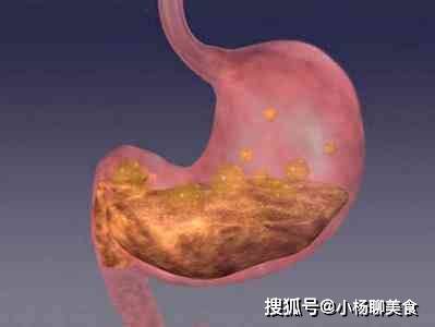 最初的金养胃期是什么时候?要做到“三不合适,三不急”,很容易养胃