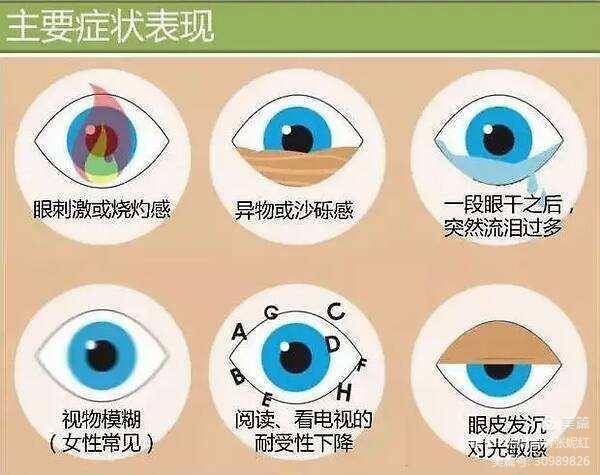 快查查你的睑板腺!——南阳医专一附院眼科