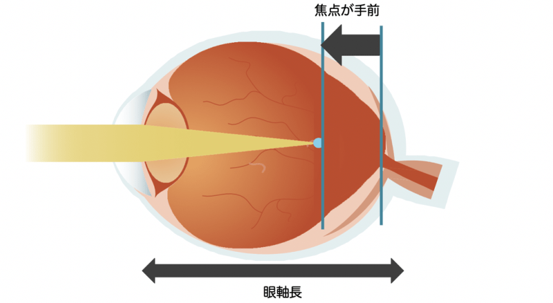 91ae7a5b1206415886c9f1ce52df0700.png