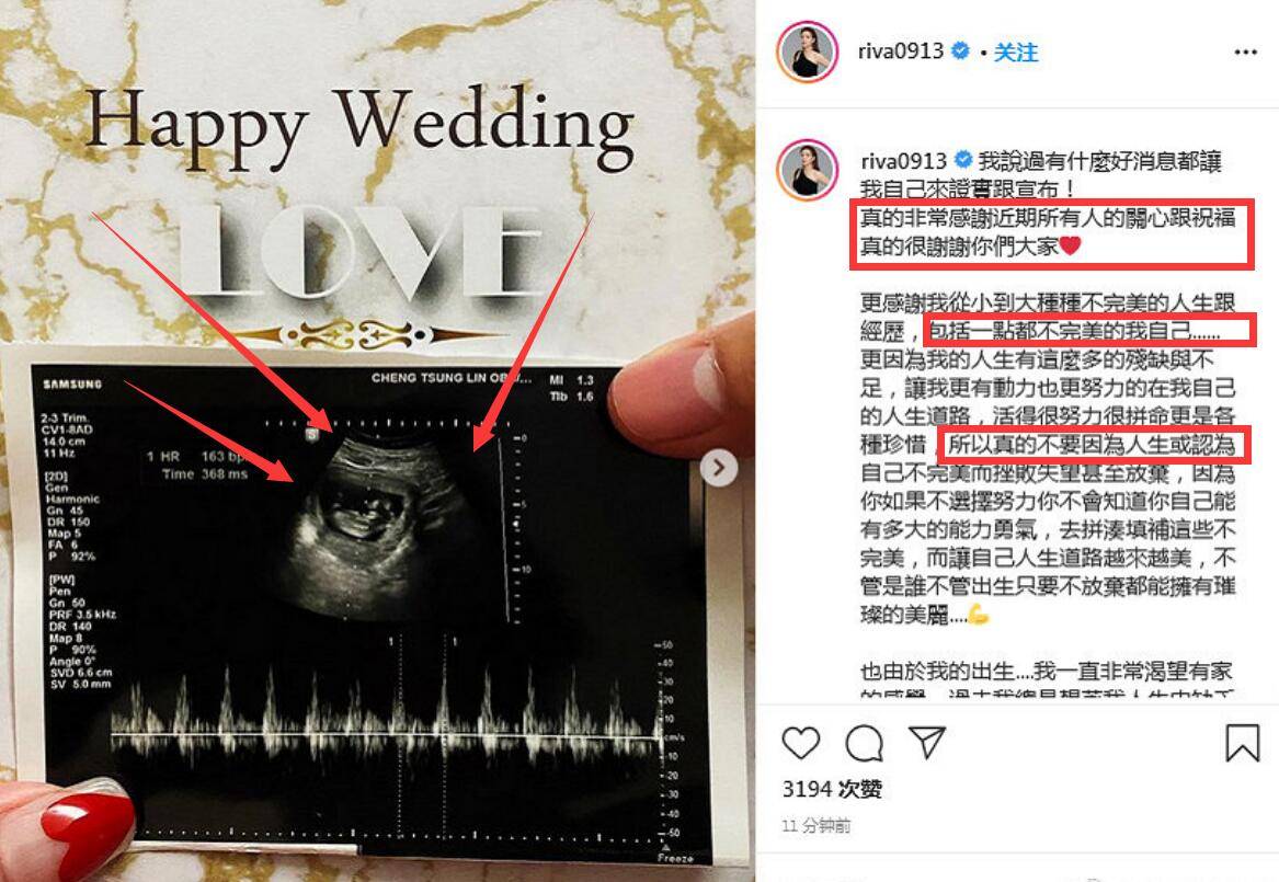 官宣！《康熙来了》小甜甜张可昀结婚并怀孕，