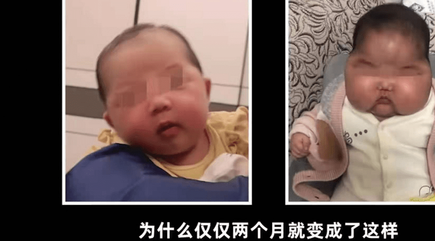 劣质宝宝“抗菌膏”曝光,宝宝完成了“大头娃娃”,家长还在买