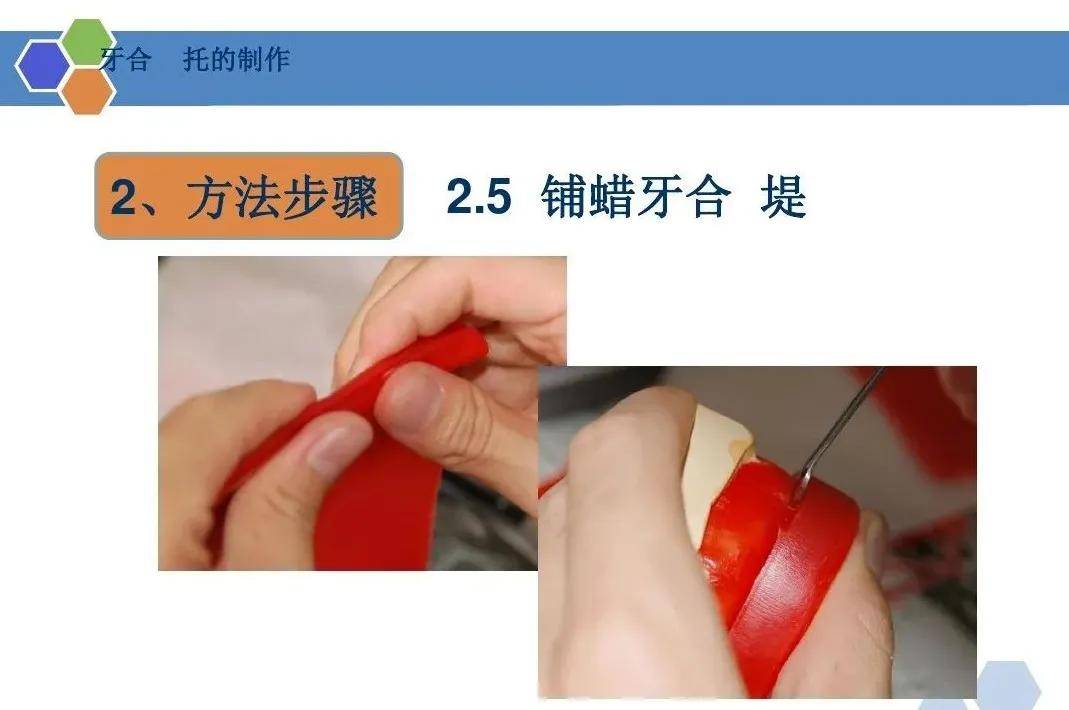 全口义齿印模制取及颌位关系记录