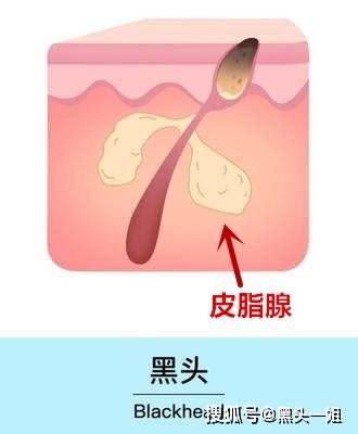 什么可以去除油腻 92ae25934c72433b84220042fcc8e4ab.jpeg