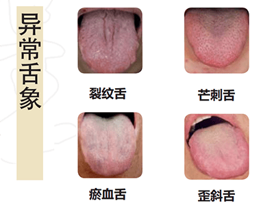 2c5a937d83bb4cf98e018d70da6903c9.png