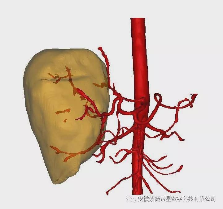 动脉血管,肝静脉血管,门静脉血管,肾脏 ,淋巴结,肝脏,脾,胰腺,胆总管