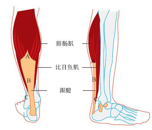 什么时候能正常走路跟腱断裂术后这样康复