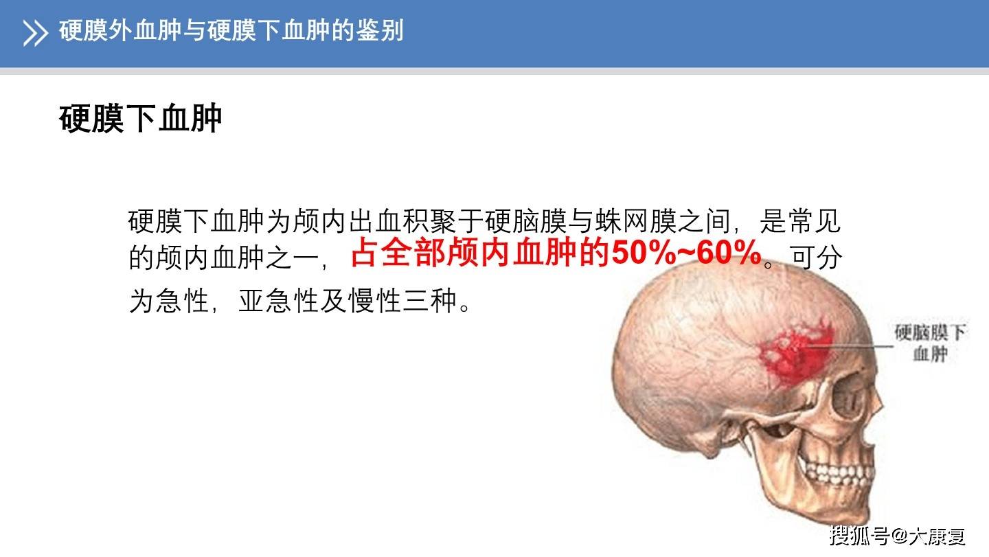 硬膜外血肿与硬膜下血肿的鉴别]