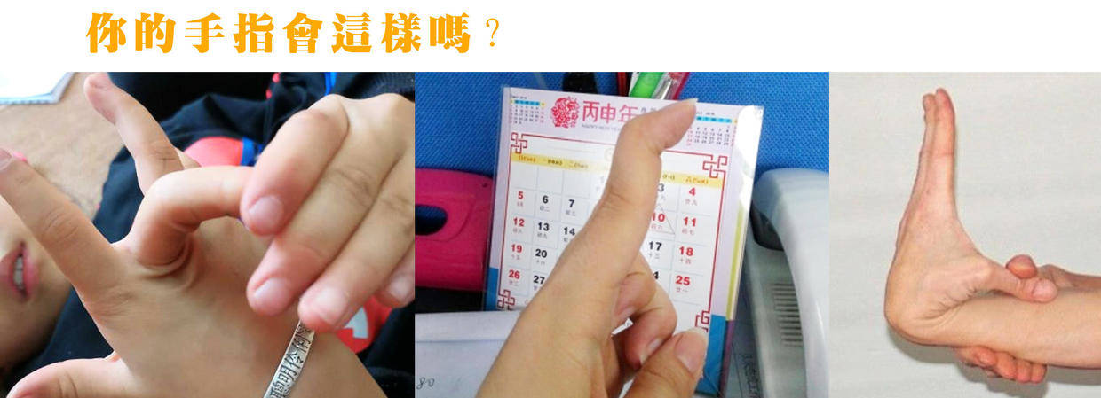 手指的各关节,也很容易弯曲得令人惊讶的程度…… 这些都是关节过度