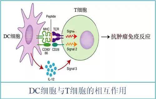 刘向善 | 树突细胞(dc)免疫疗法治疗各种实体瘤取得确切疗效!