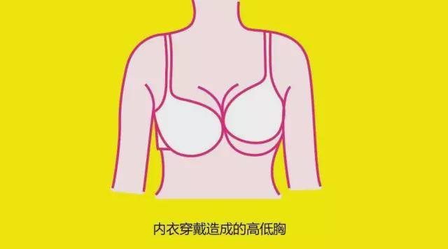 男人的蛋蛋女人的乳房发现不对称一大一小是不是疾病状态