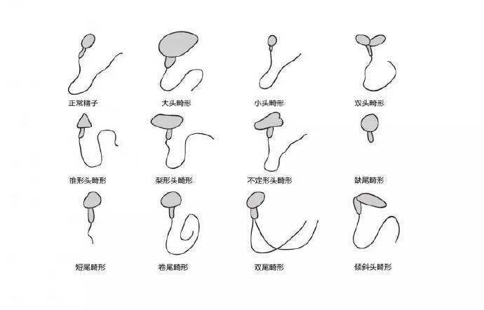 精子畸形率高还能受孕吗