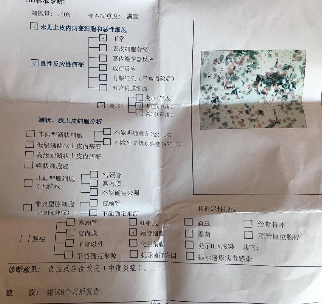 tct报告分为三个部分:第一部分:标.本满意度,分为满意和不满意.