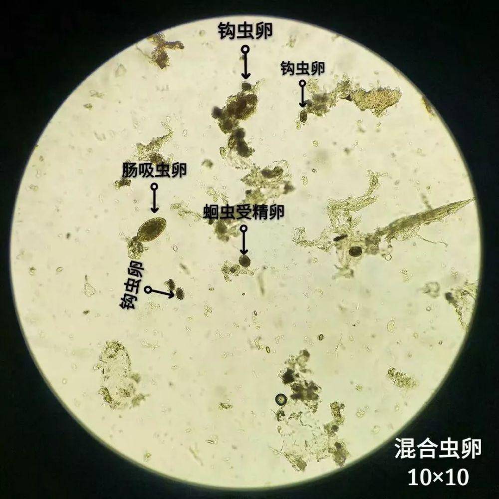 原创寄生虫吃掉猪场利润,还会造成非瘟感染率升高,如何有效驱虫?