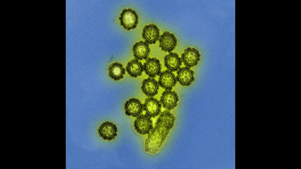 超20张微观图像,揭秘各种病毒的真实模样!