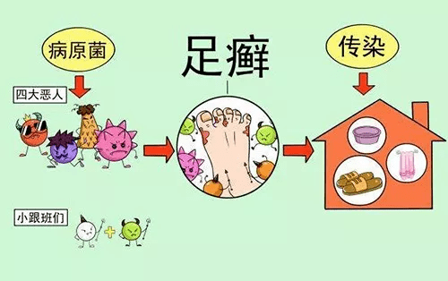 芙自在手足癣的防治别忘了根治鞋袜