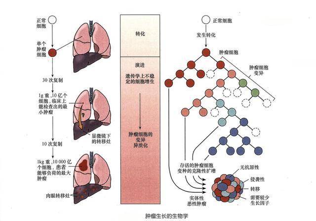 如分化差的恶性肿瘤,可在短时间内形成明显的肿块