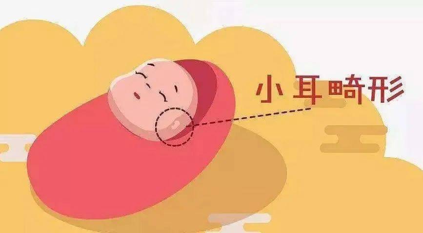六年前的她小耳畸形,六年后