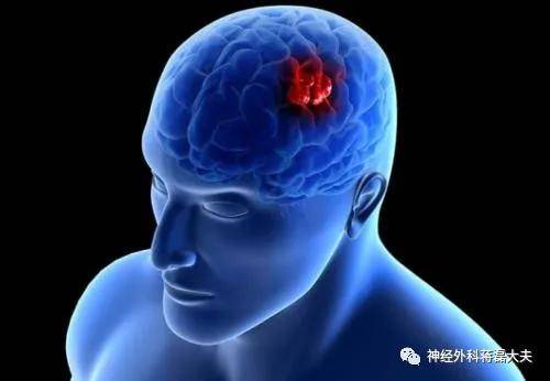 什么是胶质性脑瘤 来自搜狐网